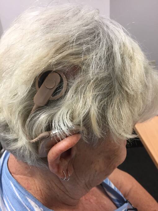 For Meerschaum Vale resident, Pam Moreland, a cochlear implant has proved life changing.