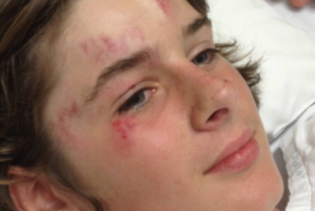 Young Matt Cooper sporting injuries after the crash.