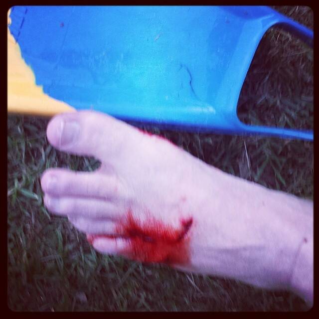 Lucky escape: A shark bit through Mike Porter's rubber flipper and into his foot on Wednesday evening. 
