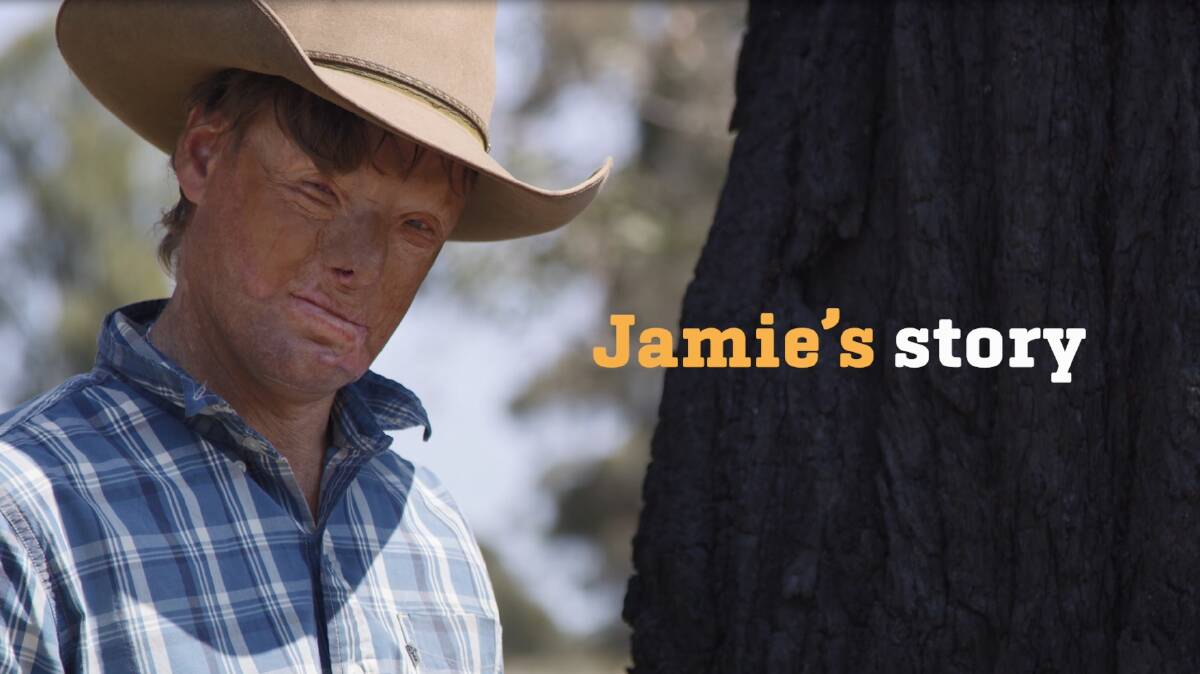 Jamie's life completely changed after just a few seconds of his attention wavering on the road.