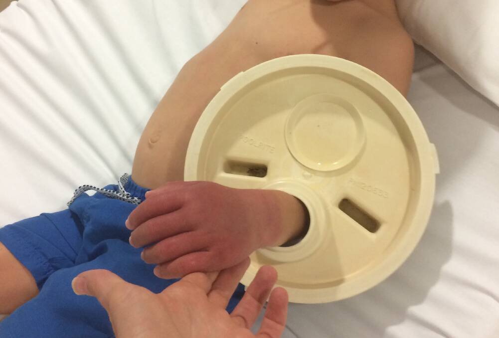 Stuck fast: Five year old's hand in quite a situation. Photo: Supplied