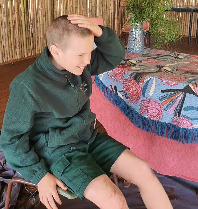 Dash Thompson after the head shave which was a fundraiser for the Mid North Coast Cancer Institute.