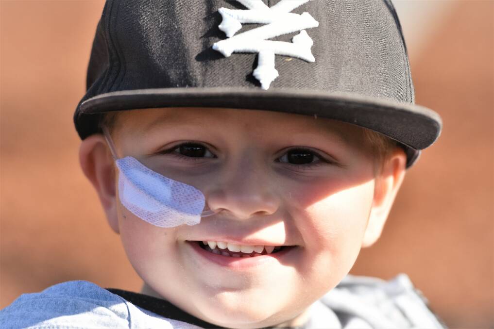 Still smiling: Although Austin Roper, 3, has a tube in his nose he still loves to smile. Photo: Matt Attard